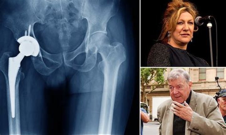 
Renee Geyer Death Cause: Hip Surgery Complications Led To Tragic Death 